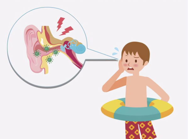 中耳炎患者可以游泳吗